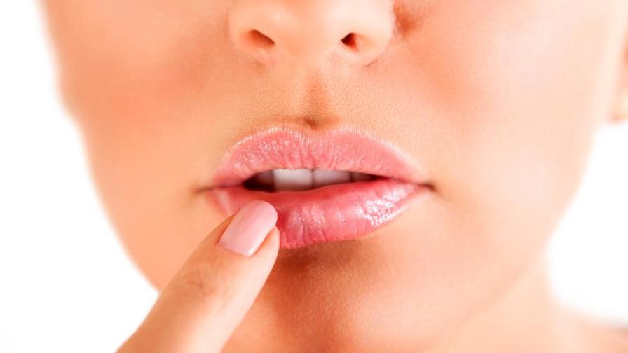 Herpes labial: estas son las tres causas principales