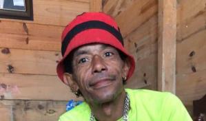 Muere hombre que fue quemado por su pareja mientras dormía en Moca