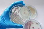 Hombre de Texas muere por la bacteria come carne tras consumir ostras crudas