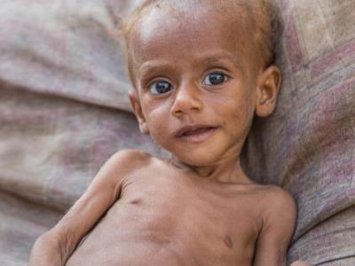 Al menos 500 niños  murieron de hambre por guerra en Sudán