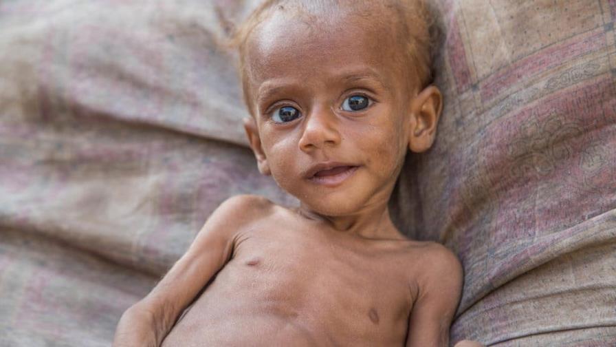 Al menos 500 niños sudaneses murieron de hambre en cuatro meses de guerra