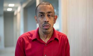 Joven con discapacidad pide ayuda para conseguir trabajo