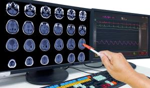 Un nuevo estudio abre camino a la detección precoz de la metástasis cerebral