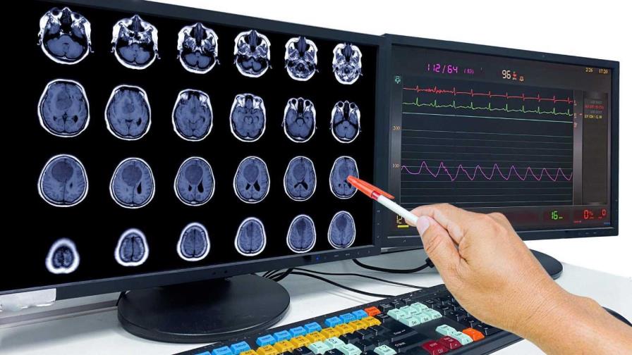 Un nuevo estudio abre camino a la detección precoz de la metástasis cerebral