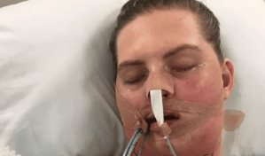 Infecci&oacute;n en una muela del juicio deja en coma a una joven de 27 a&ntilde;os en Australia