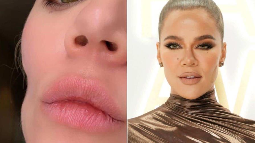 Khloé Kardashian muestra su cicatriz por cáncer de piel