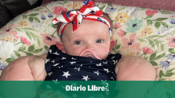 Baby Hulk una historia inspiradora Diario Libre