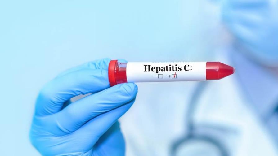 Dra. Fabiolina Sánchez: "Hay muchos pacientes curados de hepatitis C en el país"