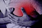 Estudio vincula la enfermedad renal crónica con el paro cardiaco súbito en adultos latinos Estudio vincula la enfermedad renal crónica con el paro cardiaco súbito en adultos latinos