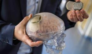 Científicos crean un atlas de células cerebrales que permitirá curar trastornos mentales