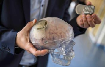 Científicos crean un atlas de células cerebrales que permitirá curar trastornos mentales