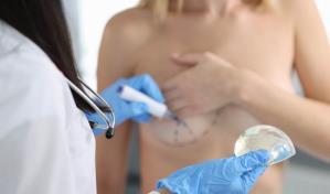 Reconstrucción mamaria: qué opciones hay