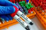 El rol de los genes en el cáncer de mama El rol de los genes en el cáncer de mama