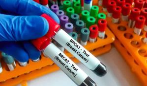 El rol de los genes en el cáncer de mama