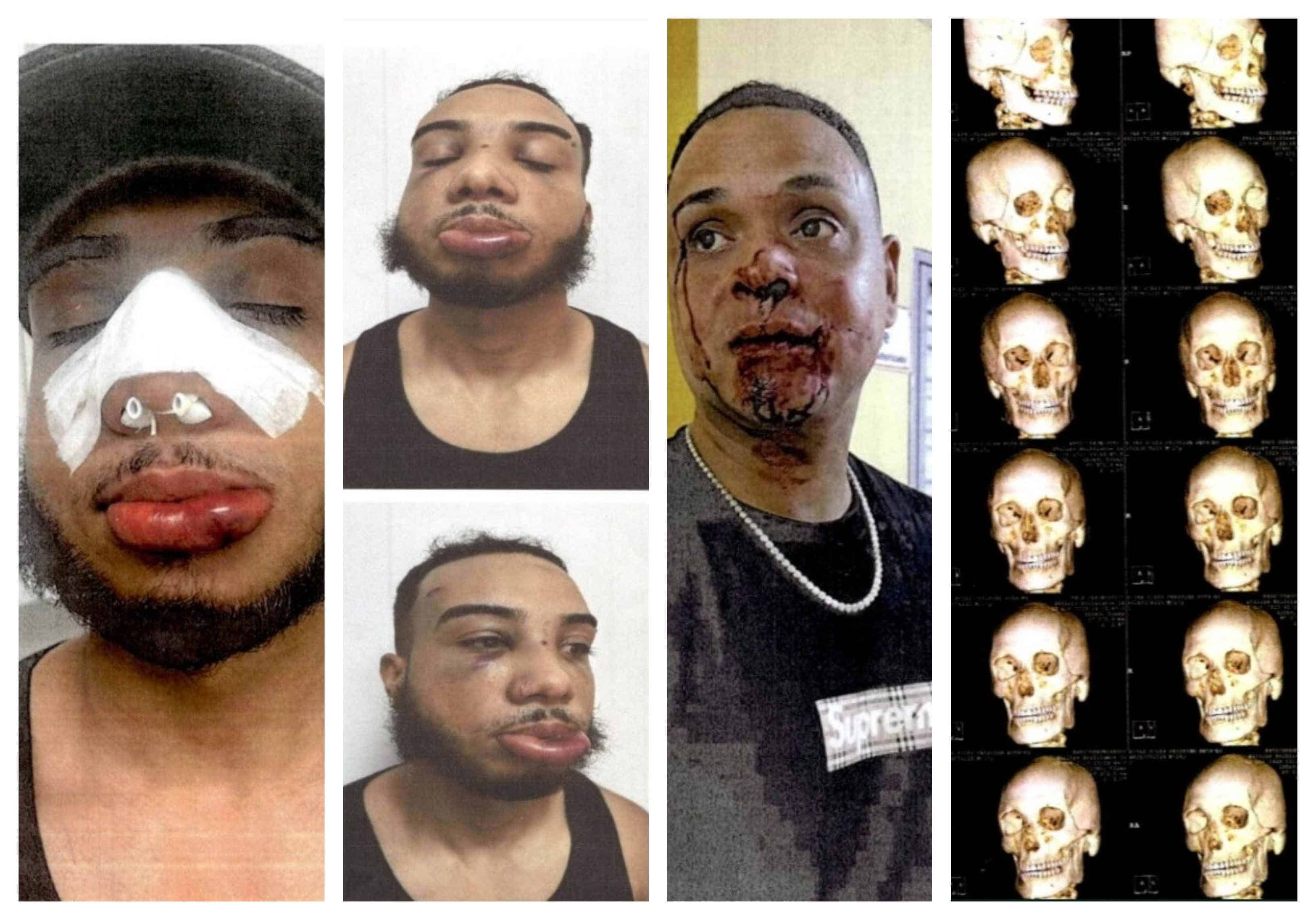 [object HTMLTextAreaElement]