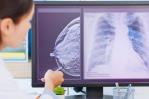 La inteligencia artificial detecta el cáncer de mama cinco años antes de que se desarrolle