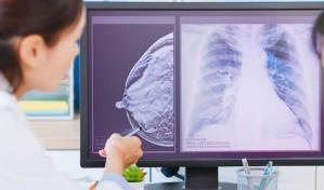 La inteligencia artificial detecta el cáncer de mama cinco años antes de que se desarrolle