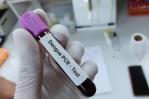 Realizan prueba PCR para agilizar resultados de muestra de dengue Realizan prueba PCR para agilizar resultados de muestra de dengue