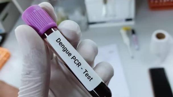 Realizan prueba PCR para agilizar resultados de muestra de dengue