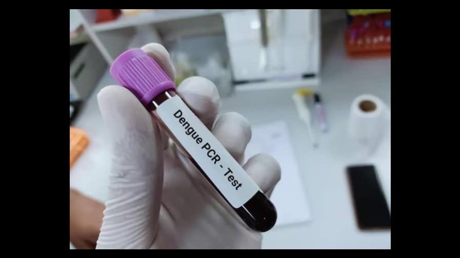 Realizan prueba PCR para agilizar resultados de muestra de dengue