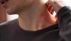 Bioimpresión Tridimensional,  una gran innovación para el estudio de enfermedades de la piel