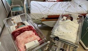 Dos siamesas mauritanas son separadas con &eacute;xito en Espa&ntilde;a