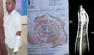 Migración aclara incidente en el que agente de la institución agredió motociclista