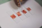 La ciencia médica y la anemia falciforme La ciencia médica y la anemia falciforme