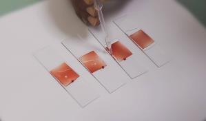 La ciencia médica y la anemia falciforme La ciencia médica y la anemia falciforme