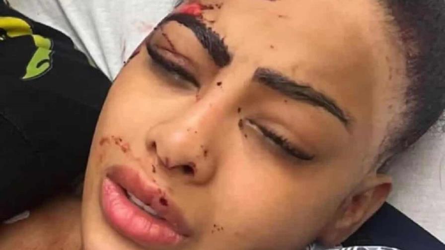 Circula imagen de Yailin con heridas y golpes en el rostro; ¿qué le sucedió? Circula imagen de Yailin con heridas y golpes en el rostro; ¿qué le sucedió?