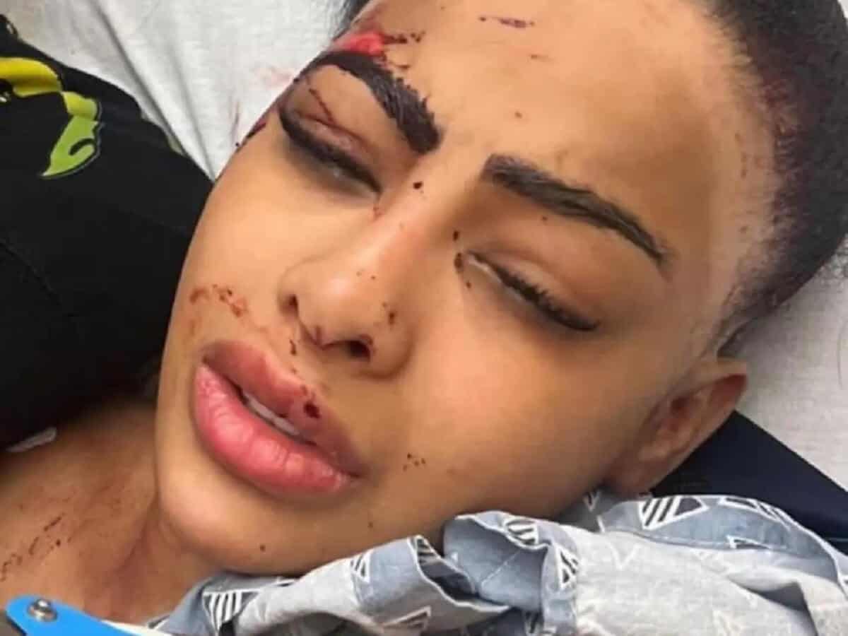 Yailin La Más Viral reaparece con su rostro golpeado; ¿qué le pasó? -  Diario Libre