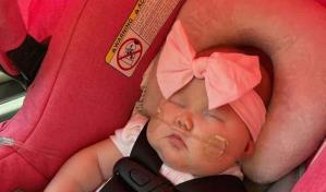 Ni&ntilde;a de EE.UU. sorprende con su recuperaci&oacute;n tras nacer sin ojos y extirparle la mitad del cerebro