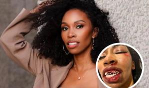 Imágenes sin censura de Carrie Bernans, actriz de Black Panther en el hospital tras ser atropellada