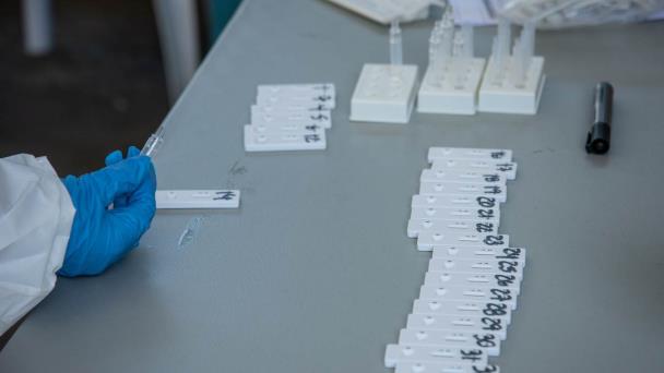 Epidemiólogo reitera COVID-19 “está presente y sigue aumentando” en República Dominicana