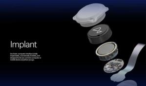 Telepathy, el primer chip cerebral implantado a un ser humano