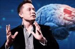 Elon Musk asegura que ya se implantó el primer chip cerebral de Neuralink en un ser humano Elon Musk asegura que ya se implantó el primer chip cerebral de Neuralink en un ser humano