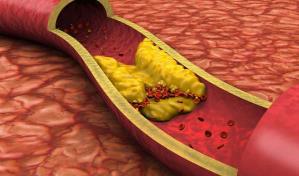 Descubren una vía para potenciar el efecto de los fármacos que reducen el colesterol