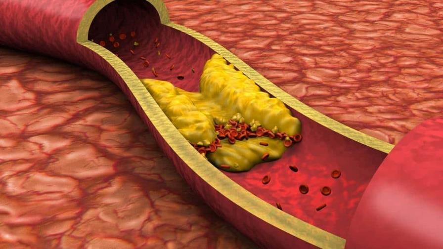 Descubren una vía para potenciar el efecto de los fármacos que reducen el colesterol
