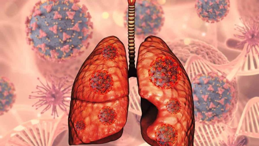 Virus sincitial respiratorio (VSR) y la evolución de la salud pública dominicana