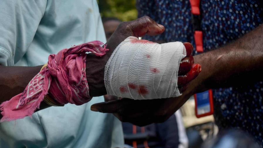 Se intensifican manifestaciones antigubernamentales en Haití, que dejan al menos un herido