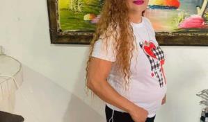 Hombre le prende fuego a una mujer en Salcedo; su estado de salud es delicado