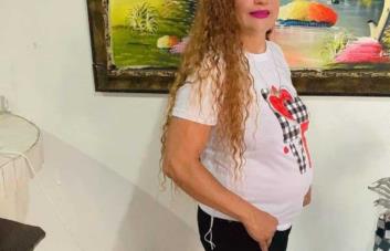 Hombre le prende fuego a una mujer en Salcedo; su estado de salud es delicado