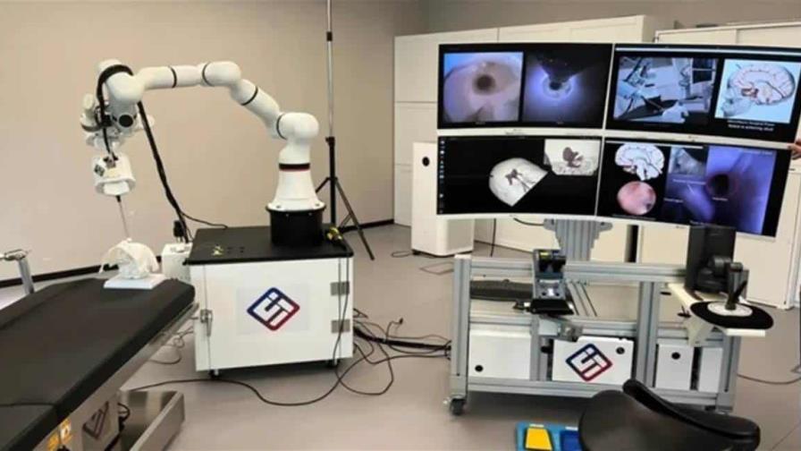 Científicos chinos crean robot más preciso que cateterismo ante aneurisma y tumor cerebral