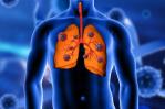 Presentan nuevas terapias para pacientes con cáncer de pulmón, estómago, renal y melanoma Presentan nuevas terapias para pacientes con cáncer de pulmón, estómago, renal y melanoma