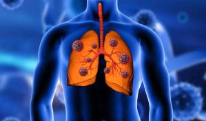 Presentan nuevas terapias para pacientes con cáncer de pulmón, estómago, renal y melanoma