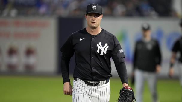 Codos de Cole y Giolito llaman la atención previo a juego de práctica entre Yanquis y Medias Rojas