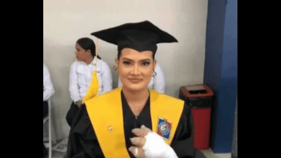 Joven afectada por fuego en Salcedo se graduó de medicina minutos antes de la muerte de su hijo