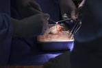 Un hospital estadounidense trasplanta por primera vez un riñón de cerdo a un humano vivo