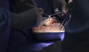 Un hospital estadounidense trasplanta por primera vez un riñón de cerdo a un humano vivo