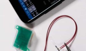 Un implante y una aplicación para ayudar a controlar el funcionamiento de la vejiga